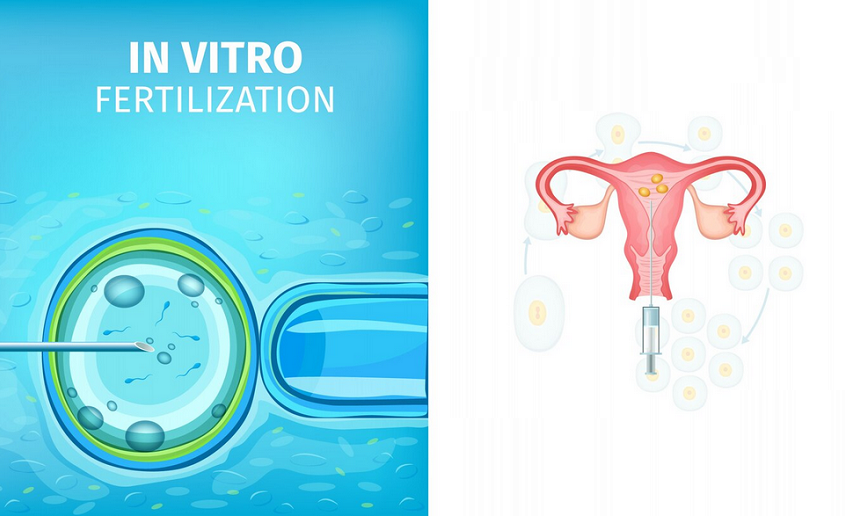 Delivering Excellence in Fertility and IVF Treatment at Kiran Infertility Centre