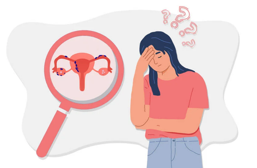 What can cause infertility in women?